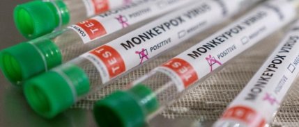 Dünya Sağlık Örgütü, M çiçeği virüsüne karşı ilk aşıya onay verdi