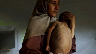 Gazze’deki poşet bezli bebek savaşın acı sembolü hâline geldi